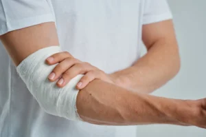Soft Tissue Injury Car Accident Settlements in California